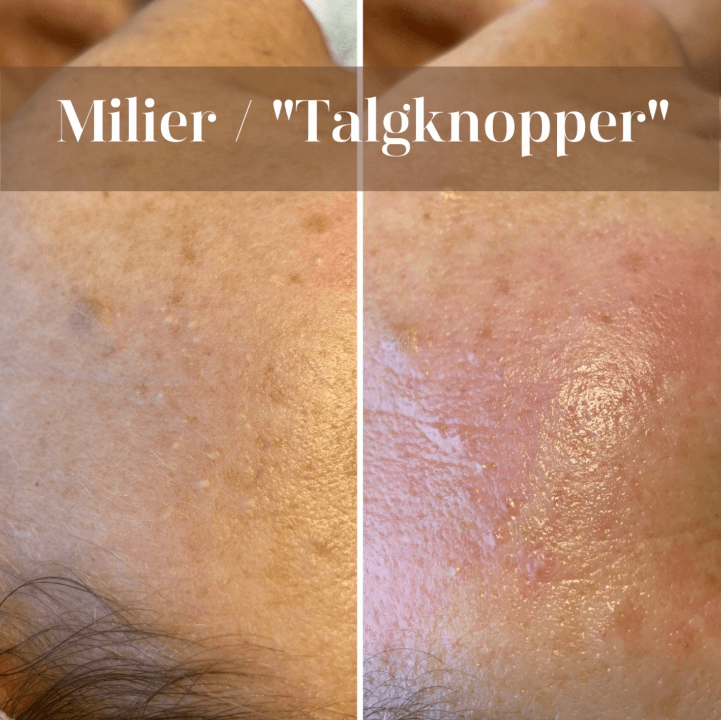 Instagram-opslag fra klinikken